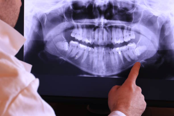 Best Emergency Root Canal Treatment in Italy, TX